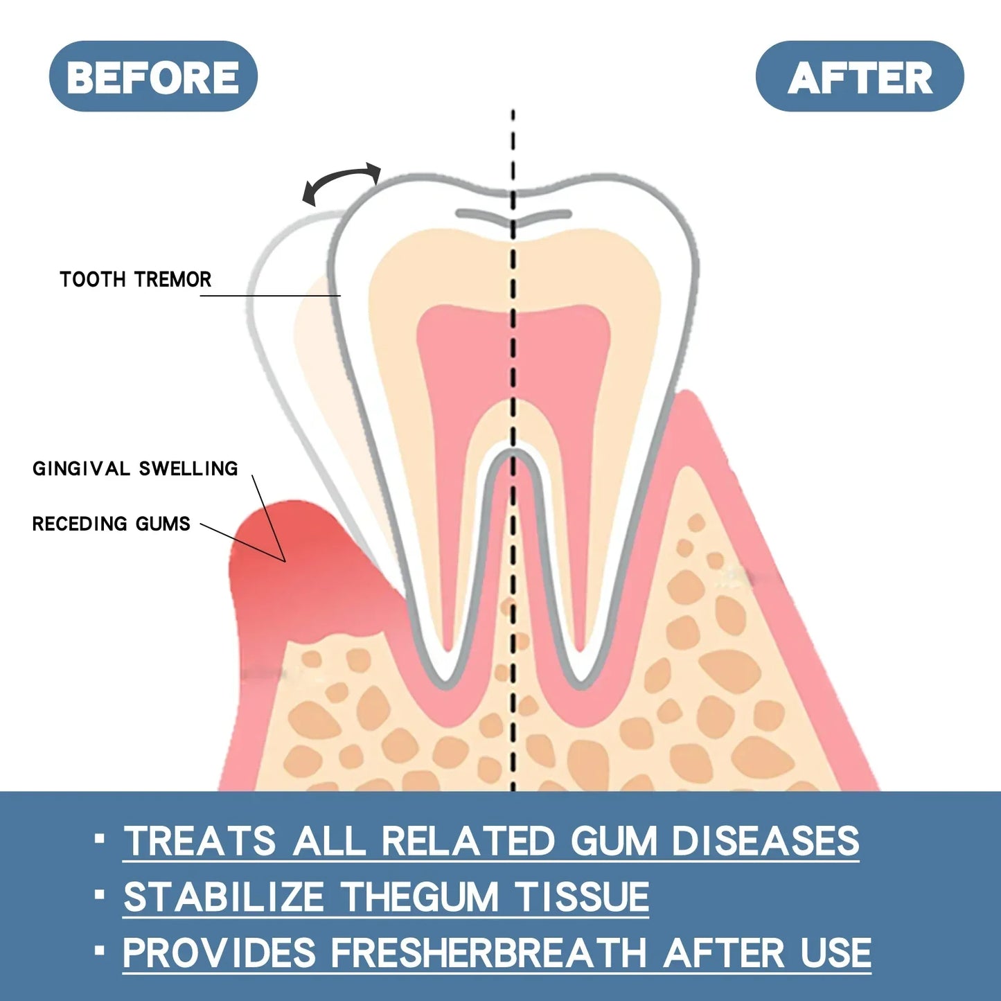 Rapid Repair Gum Serum Drops