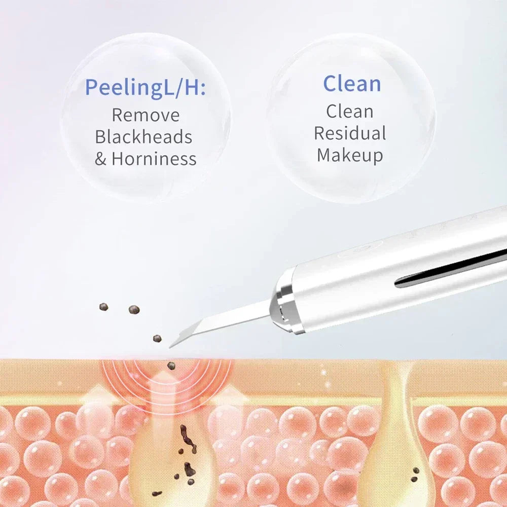 Electric Facial Pore Cleansing Spatula